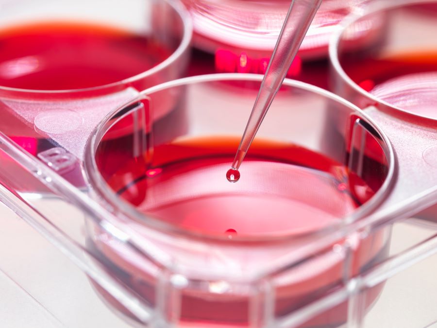 MSC serum-free media concept