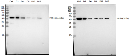 protein marker detect by Western blot -TSG101